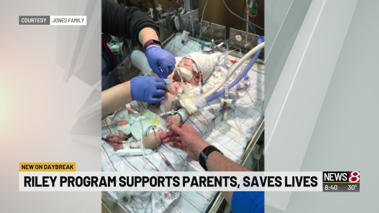 Riley program drastically reduces death rate for babies with rare heart ...