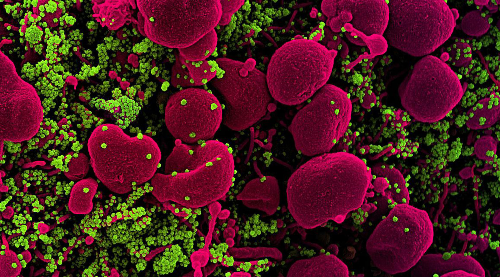 Micrography Test Examples Indiana coronavirus links and timeline - WISH-TV