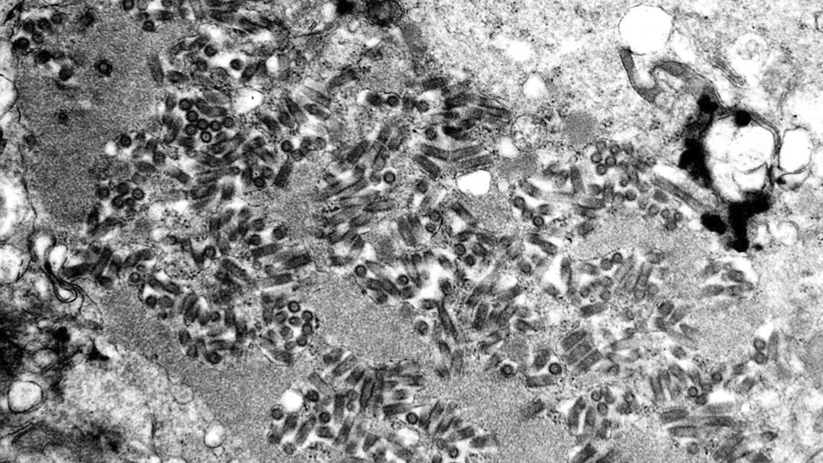CDC warns of rising rabies exposure as inquiry rates jump 17%